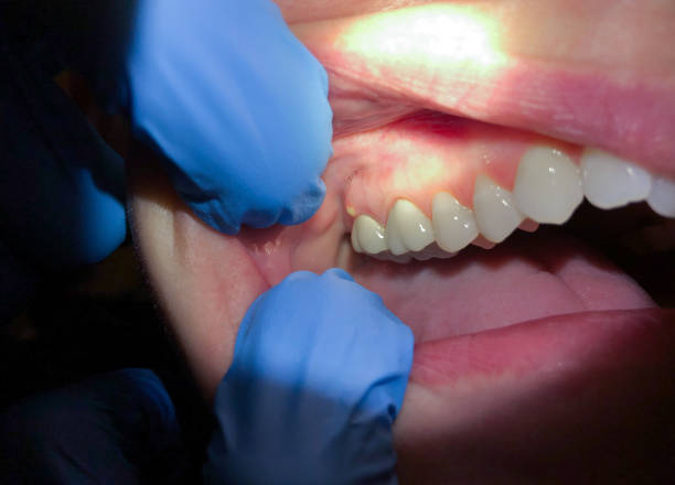Best Pediatric Emergency Dentist in Wetumpka, AL